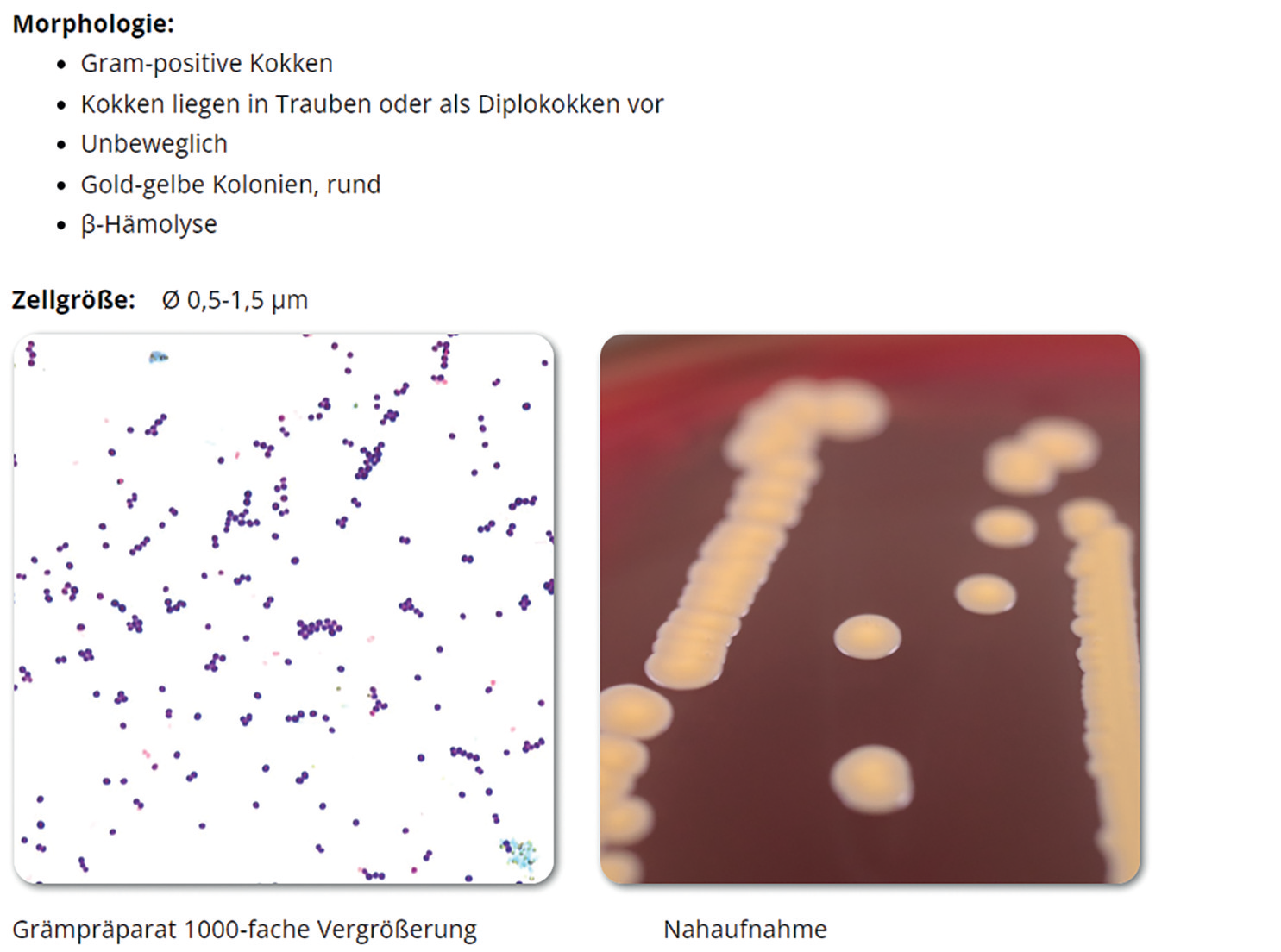 Enzyklopädie für die Mikrobiologie | Wallhäußer Innovation Award 2024